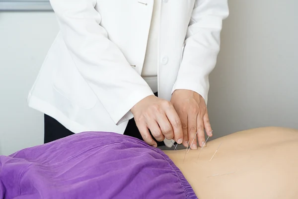 Dry needling and western medical acupuncture